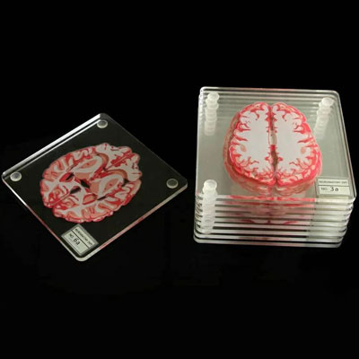 Brain Anatomy Coasters